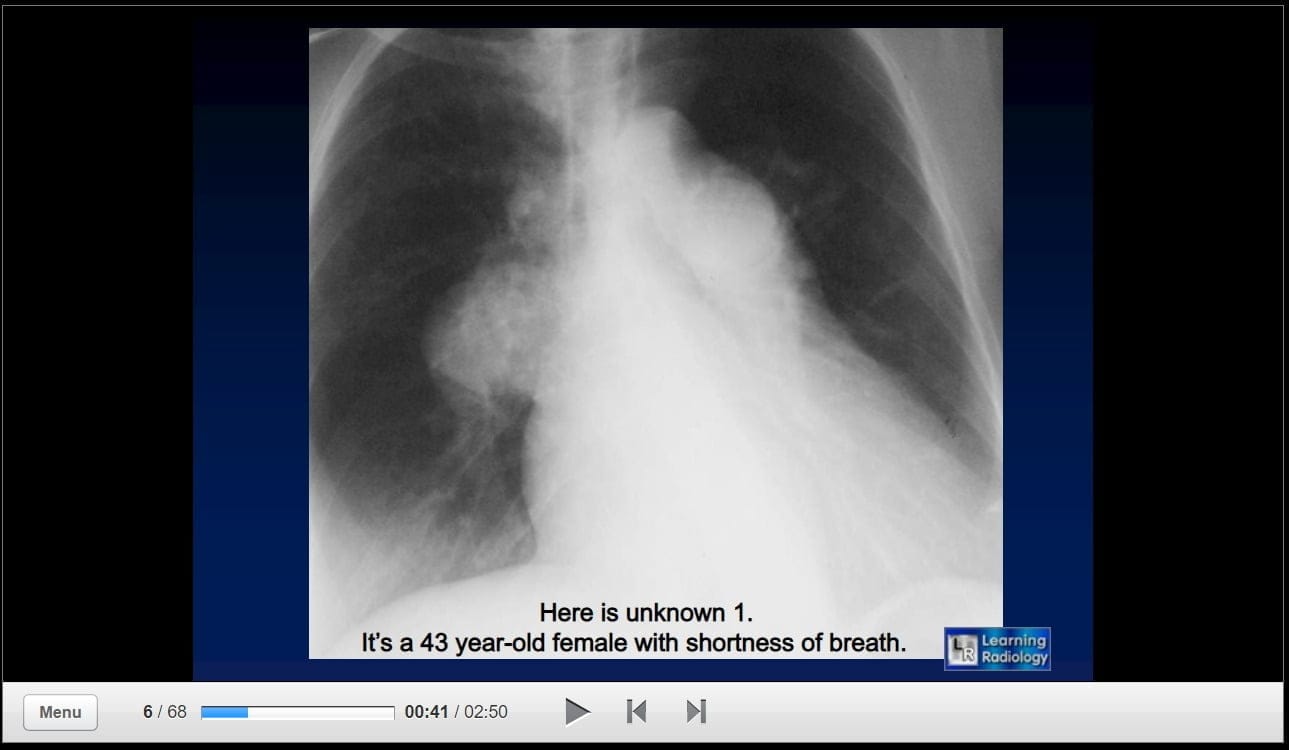 LearningRadiology – RadAide