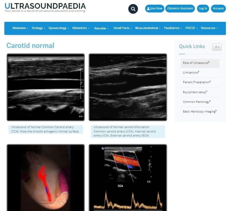 ultrasoundopaedia – RadAide