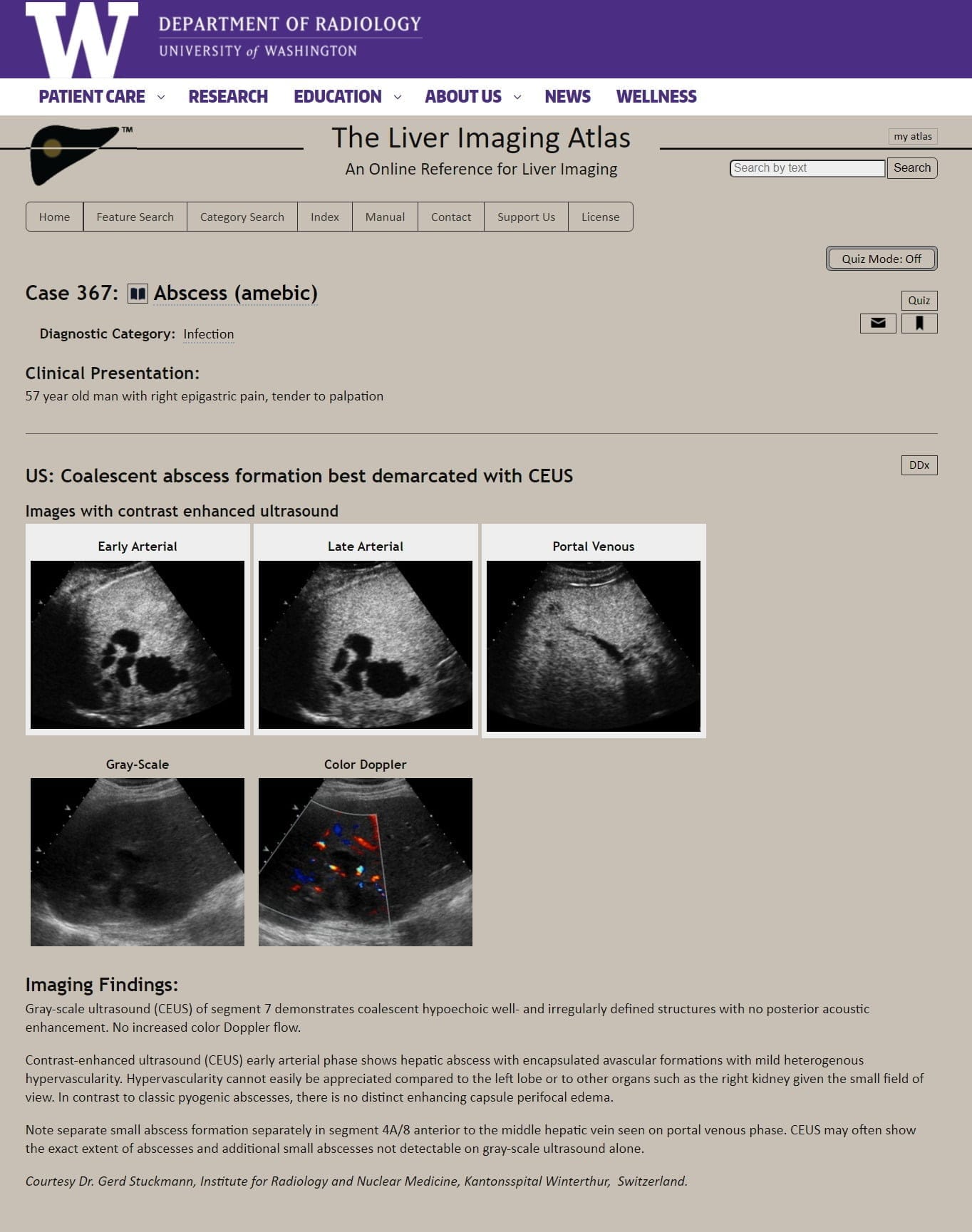 liver atlas RadAide