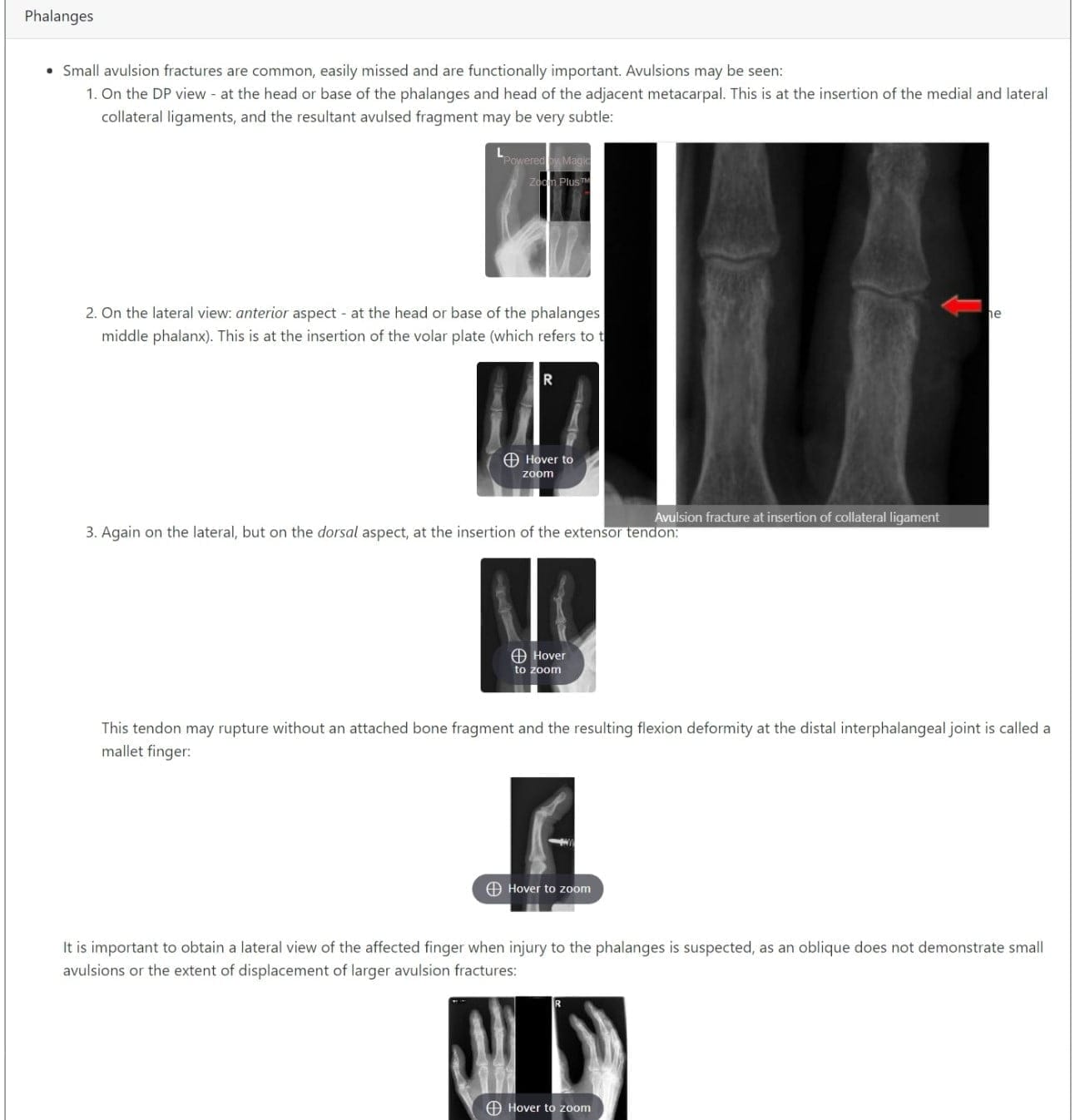 MSK radiographs radaide