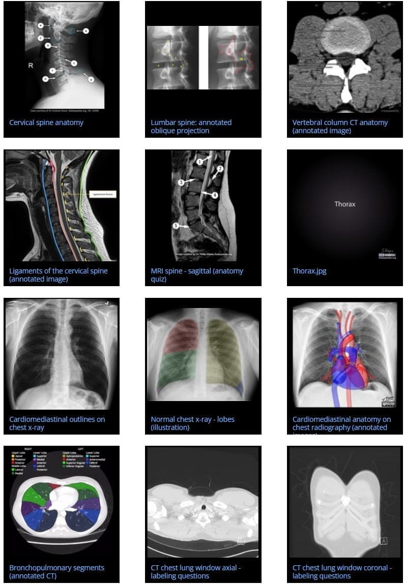 Web capture_28-1-2023_203052_radiopaedia.org