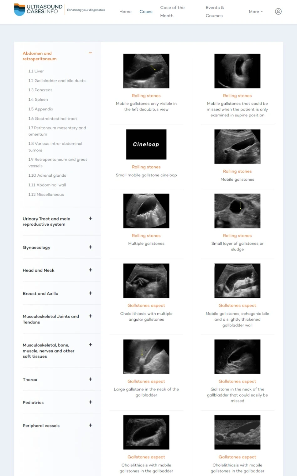 ultrasoundcases.info radaide