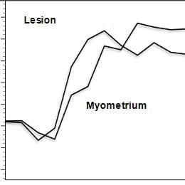 High risk time*** intensity curve