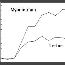 Intermediate risk time** intensity curve