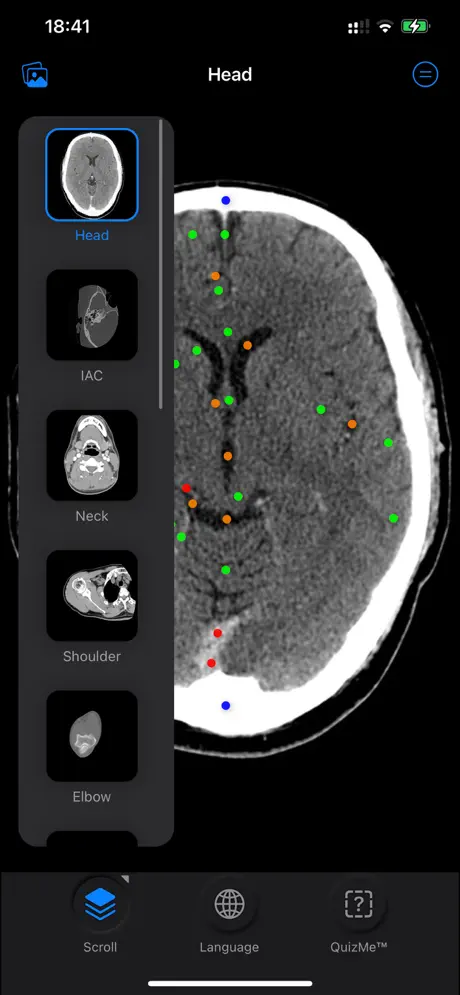 ct anatomy