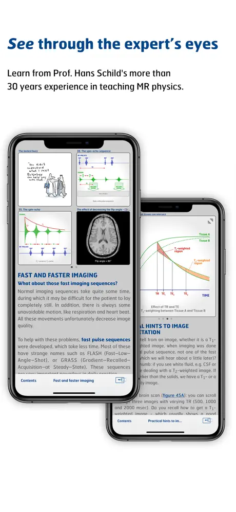 mri