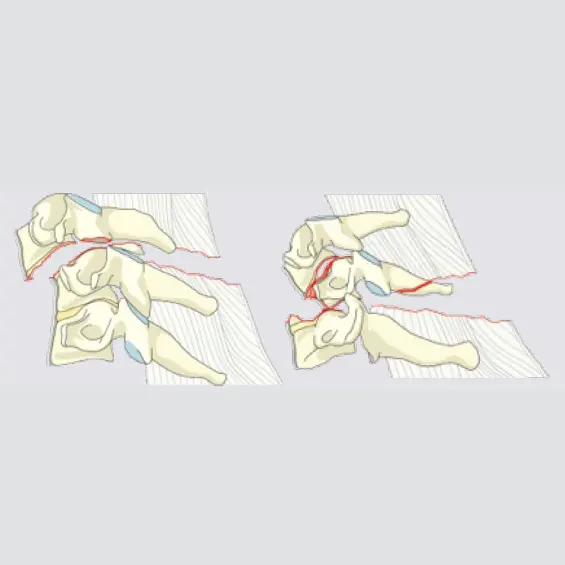 Displacement or translation in any axis