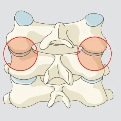 Bilateral injuries