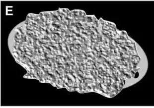 Solid/Solid-appearing Lesion (≥ 80% solid)