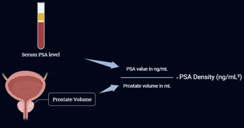 prostate volume calculator psa density calculator