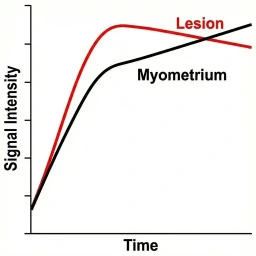 Low risk time* intensity curve
