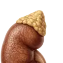 adrenal ct washout calculator for characteriziation of adrenal nodules