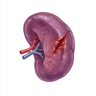 spleen injury grading calculator for splenic trauma using aast guidelines 2
