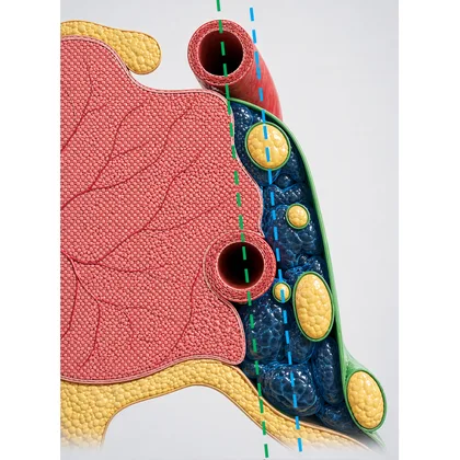 Between the intercarotid line and the lateral tangent