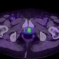 PSMA-RADS 2.0 classification for PSMA PET CT prostate cancer imaging