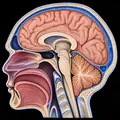 Bern Score spontaneous intracranial hypotension brain MRI findings illustration