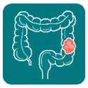 ACR C-RADS Calculator for colonic findings on CT Colonography