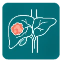 ACR LI-RADS calculator for liver lesions