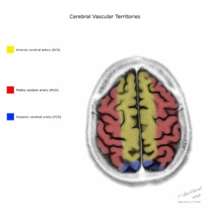 Case courtesy of Frank Gaillard, Radiopaedia.org, rID: 10814 cerebral vascular territories diagram