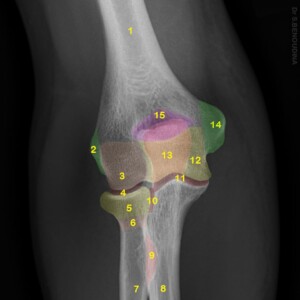 1.	Humerus
2.	Lateral epicondyle
3.	Capitellum
4.	Humero-radial joint
5.	Radial head
6.	Radial neck
7.	Radius (Shaft)
8.	Ulna (Shaft)
9.	Radial tuberosity
10.	Proximal radio-ulnar joint
11.	Humero-ulnar joint
12.	Trochlea of humerus
13.	Olecranon
14.	Medial epicondyle
15.	Olecranon fossa
16.	Trochlear notch
17.	Coronoid fossa
18.	Coronoid process
19.	Ulnar tuberosity elbow radiograph annotated