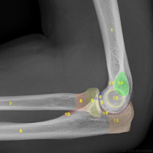 1.	Humerus
2.	Lateral epicondyle
3.	Capitellum
4.	Humero-radial joint
5.	Radial head
6.	Radial neck
7.	Radius (Shaft)
8.	Ulna (Shaft)
9.	Radial tuberosity
10.	Proximal radio-ulnar joint
11.	Humero-ulnar joint
12.	Trochlea of humerus
13.	Olecranon
14.	Medial epicondyle
15.	Olecranon fossa
16.	Trochlear notch
17.	Coronoid fossa
18.	Coronoid process
19.	Ulnar tuberosity elbow radiograph annotated