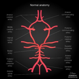 Normal anatomy Circle of willis diagram