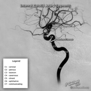 ICA segments annotated