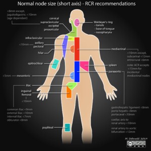 Normal lymph node sizes lymph node size normal